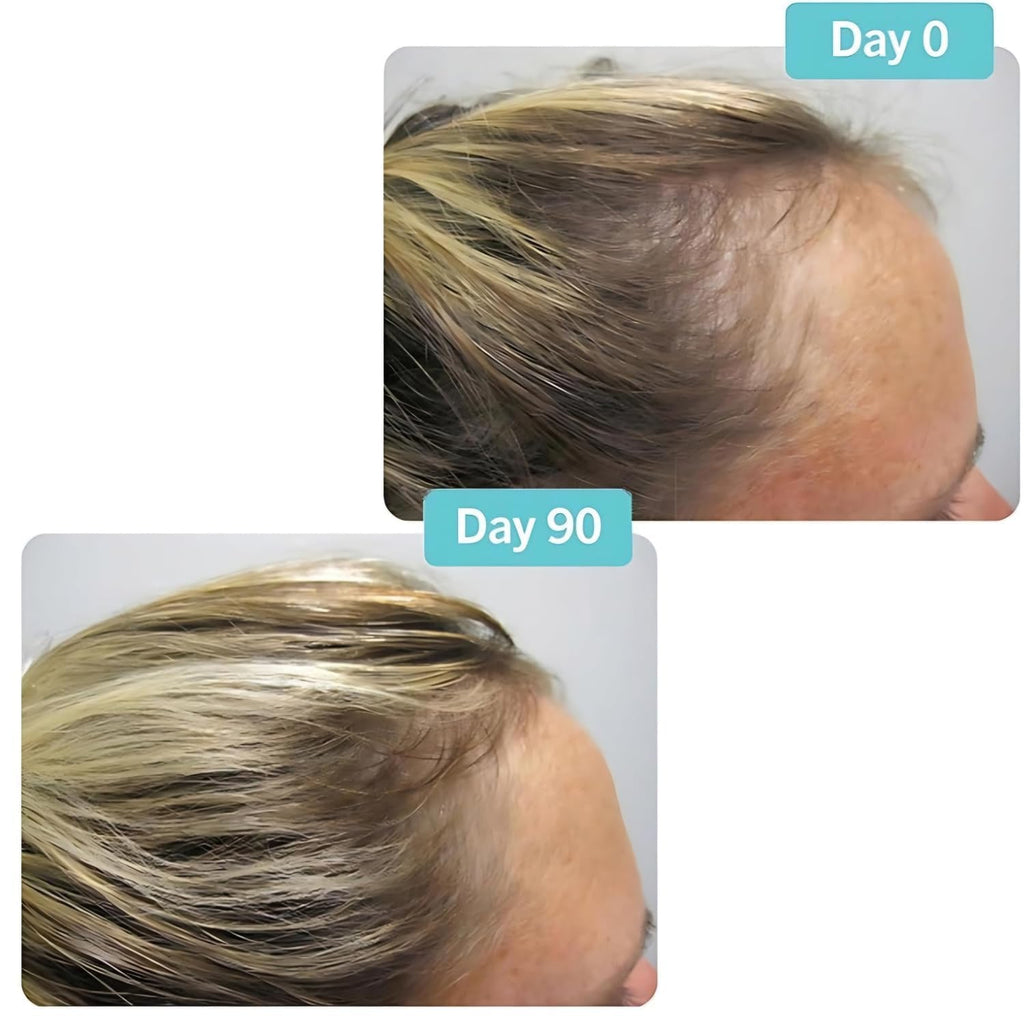 Hair Growth Supplement 180 Tablets C403