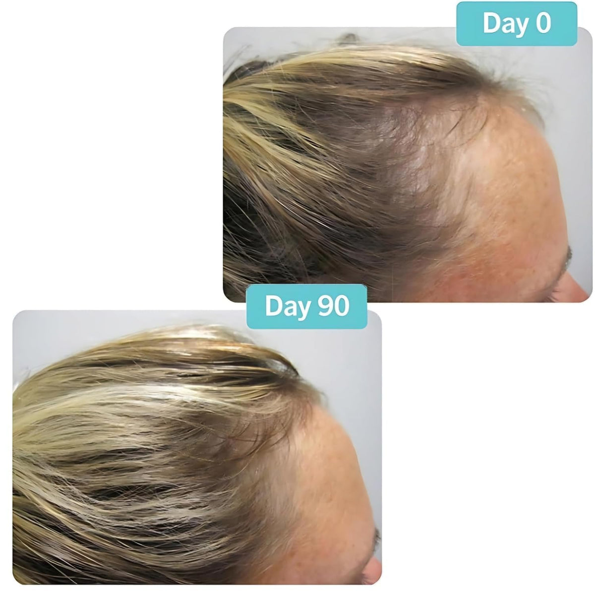 Hair Growth Supplement 180 Tablets C403